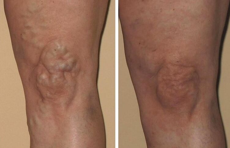 Experiência de uso de Veniselle de Alice de Praga, fotos antes e depois